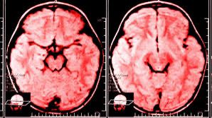 foto-cerebro