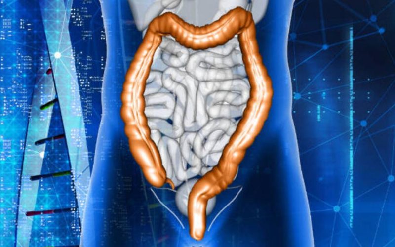 Casos de câncer colorretal vão aumentar 21% até 2040 entre homens e mulheres 
