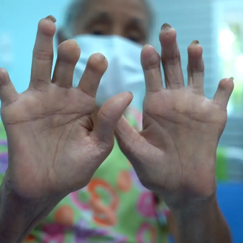 Foto: Reprodução/TV Brasil