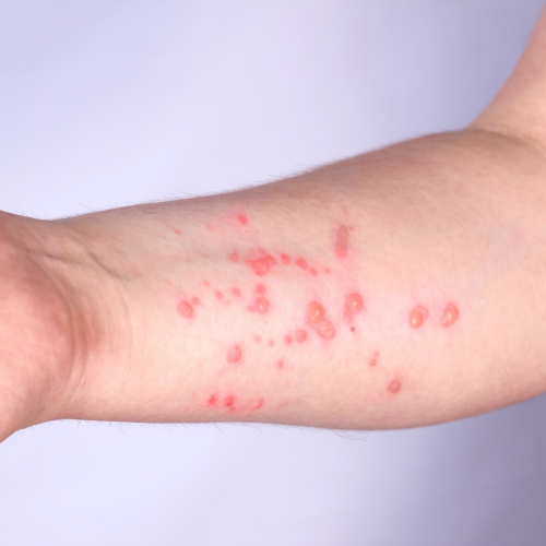 Foto: Reprodução/Gov.br/Getty Images