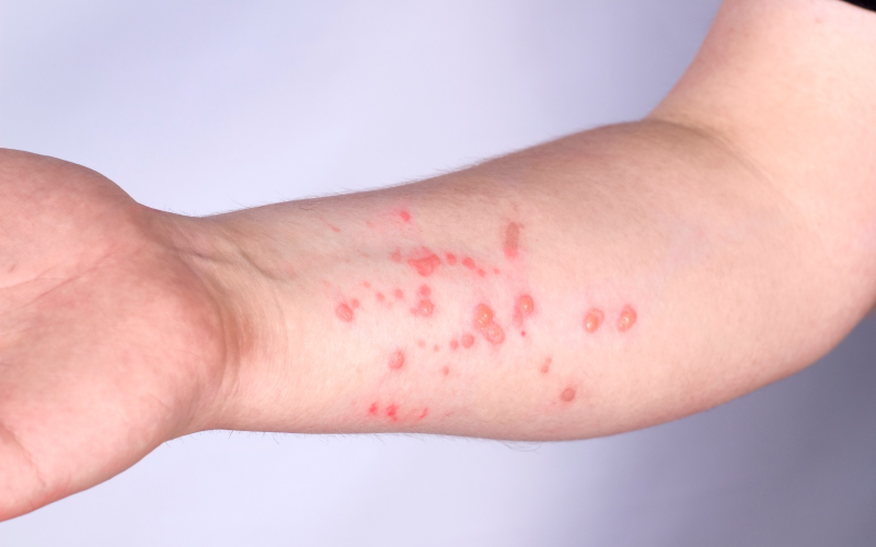 Foto: Reprodução/Gov.br/Getty Images